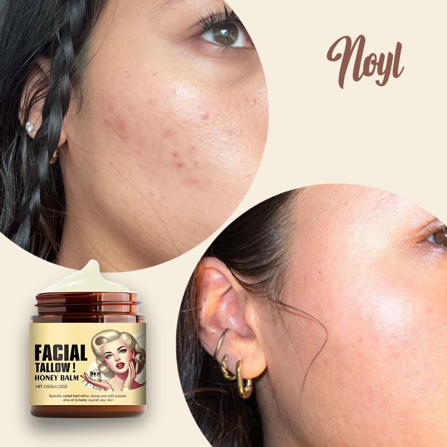 Noyl™ - Tallow Moisturizer