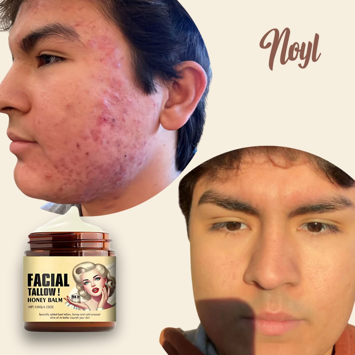 Noyl™ - Tallow Moisturizer