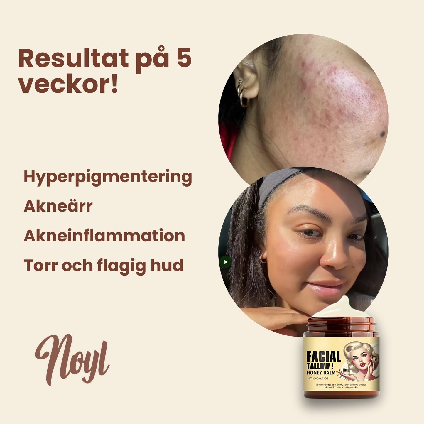 Noyl™ - Tallow Moisturizer