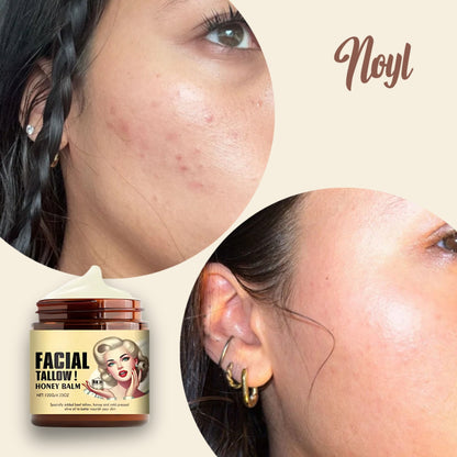 Noyl™ - Tallow Moisturizer