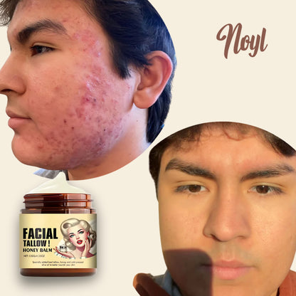 Noyl™ - Tallow Moisturizer