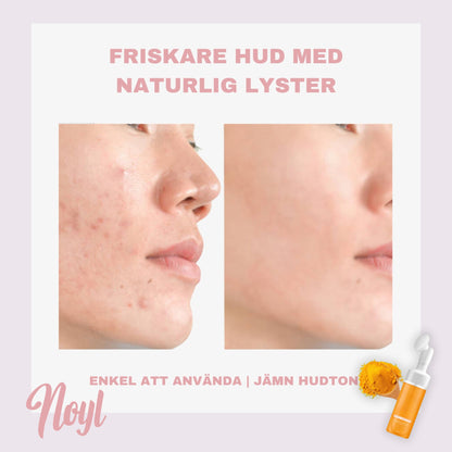 Noyl™ - Tumeric Face wash med borste
