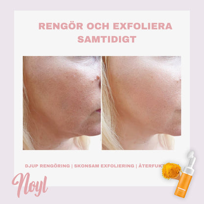 Noyl™ - Tumeric Face wash med borste